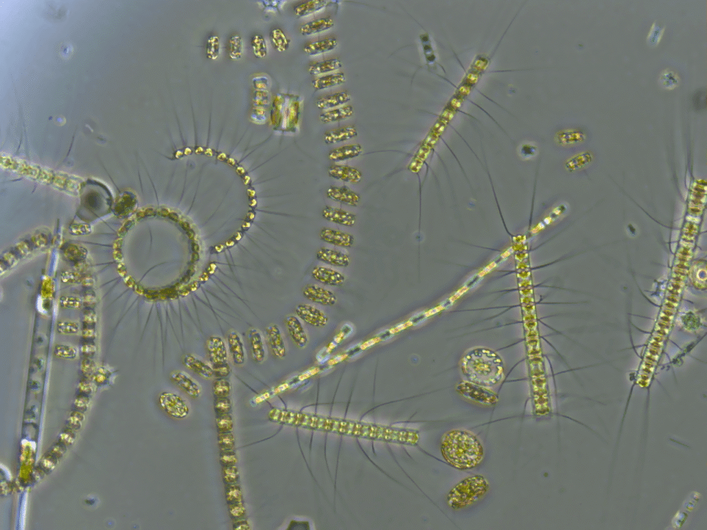 Mixed phytoplankton species viewed under a microscope, showing microscopic marine algae that produce oxygen and support ocean food webs in the North East Atlantic.